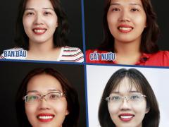  BS.CK1 Hoàng Văn Đạt và hành trình sửa sai những ca làm răng sứ hỏng