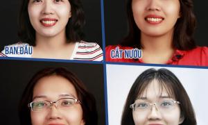  BS.CK1 Hoàng Văn Đạt và hành trình sửa sai những ca làm răng sứ hỏng